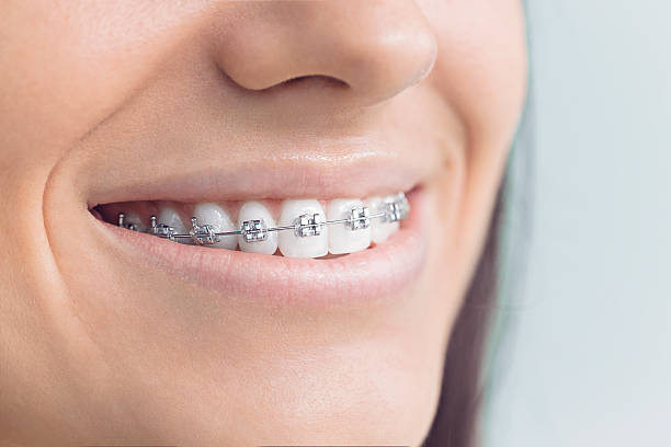 Dental Inlays and Onlays in Willowbrook, CA